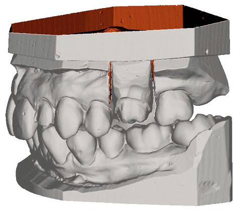 Planmeca PlanScan Lab 3